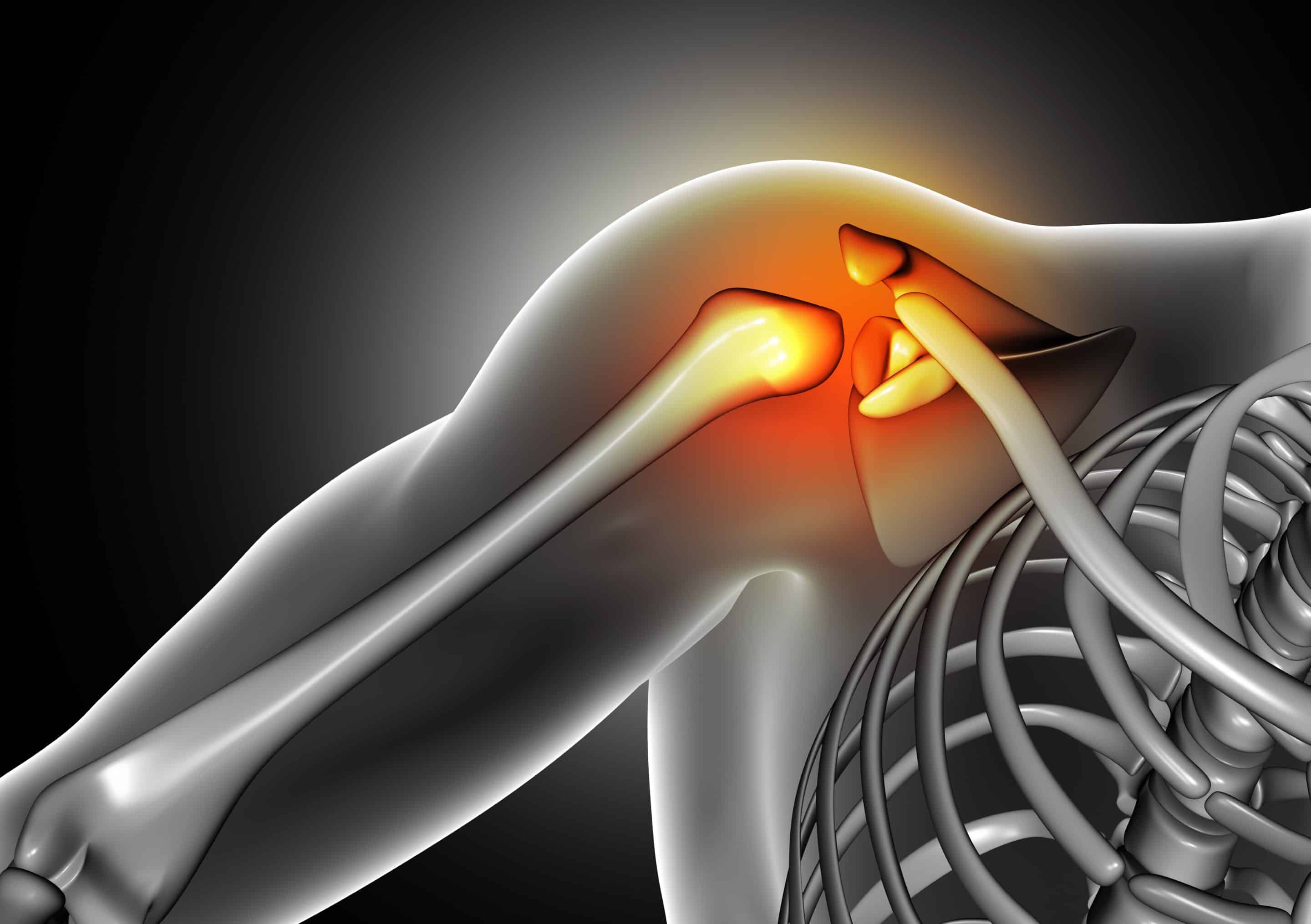 maritime shoulder injuries