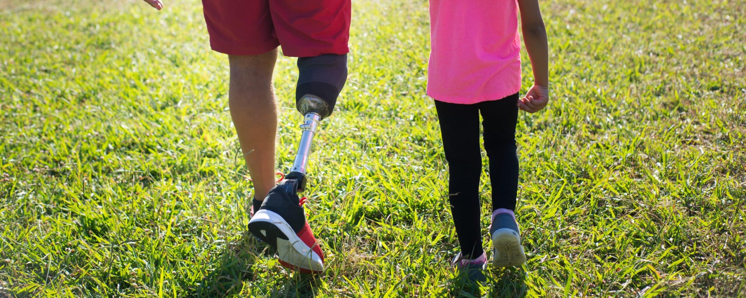 amputation accidents